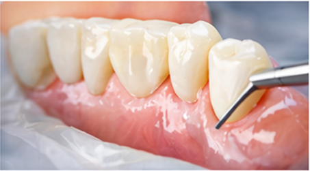 Zahnarzt Bochum - Dr. Philipp 19